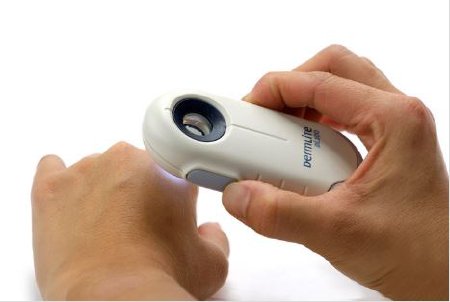 DERMATOSCOPE HANDHELD DERMLITE OIL-FREE MAGNIFYING LIGHT