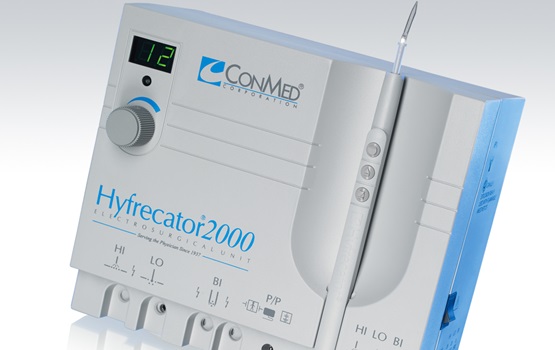 Hyfrecator® 2000 Electrosurgical System